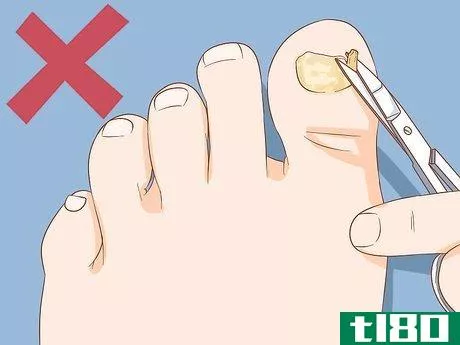 Image titled Help a Toenail Grow Back Quickly Step 9