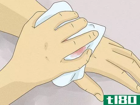Image titled Heal Cuts Quickly (Using Easy, Natural Items) Step 2