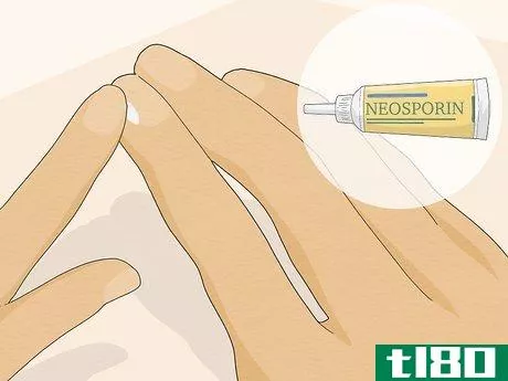 Image titled Get Rid of Hangnails Step 3