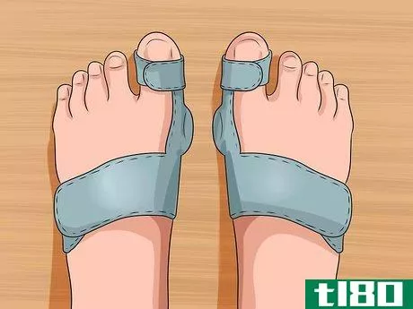 Image titled Get Rid of Bunions Step 8