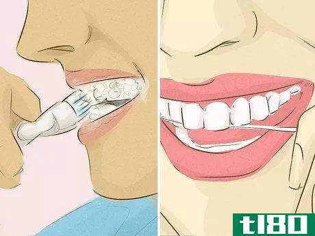 Image titled Get Whiter Teeth at Home Step 2