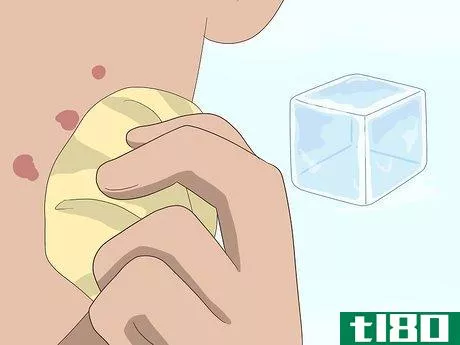 Image titled Get Rid of Acne Scars Fast Step 15