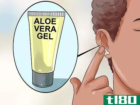 Image titled Get Rid of Pimples Inside the Ear Step 13