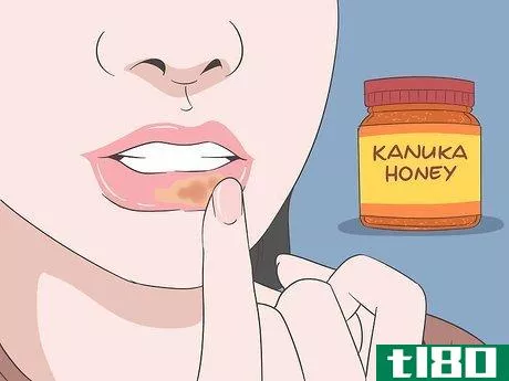 Image titled Get Rid of a Cold Sore with Home Remedies Step 1