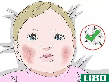 Image titled Get Rid of Baby Acne Step 8