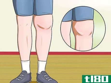 Image titled Know if You Have Arthritis in the Knee Step 5