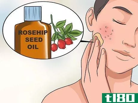 Image titled Get Rid of Large Pores and Blemishes Step 12