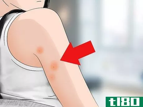 Image titled Identify Bed Bug Bites Step 1