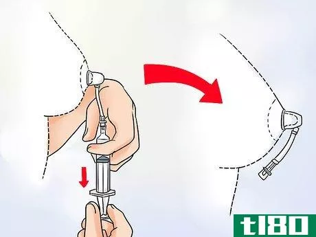 Image titled Get Rid of Inverted Nipples Step 10