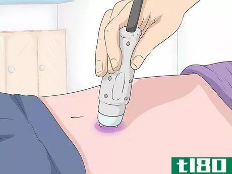 Image titled Get Rid of Psoriasis Step 12