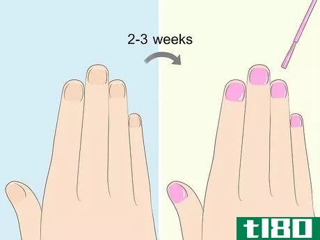Image titled Heal Damaged Nails Step 6