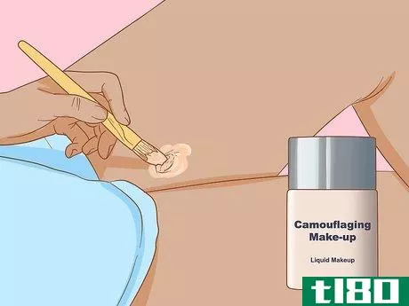 Image titled Get Rid of Boil Scars Step 11