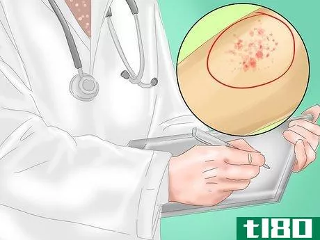 Image titled Identify Measles Step 5