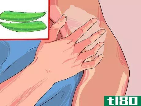 Image titled Grow and Use Aloe Vera for Medicinal Purposes Step 7