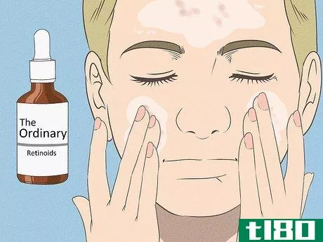 Image titled Get Rid of Acne if You Have Fair Skin Step 5