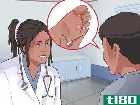 Image titled Know if You Have Athlete's Foot Step 6