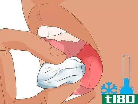 Image titled Heal a Bitten Tongue Step 12