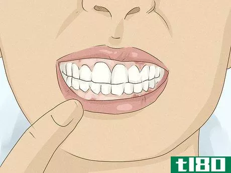 Image titled Get Whiter Teeth at Home Step 17