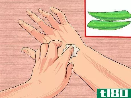 Image titled Grow and Use Aloe Vera for Medicinal Purposes Step 8