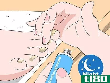 Image titled Get Rid of Psoriasis on Your Nails Step 2