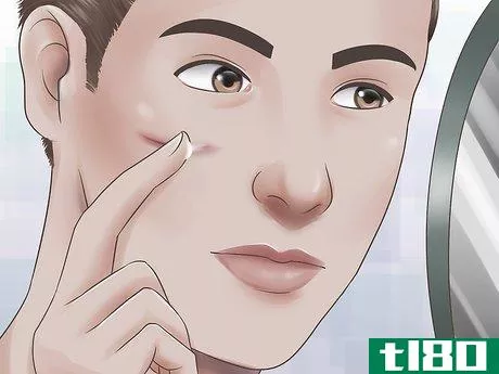Image titled Get Rid of a Cut on Your Face Step 5