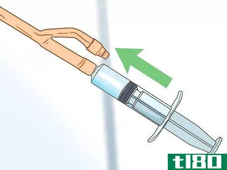 Image titled Irrigate a Foley Catheter Step 11