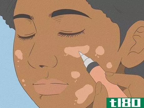 Image titled Get Rid of Spots on Your Skin Step 8