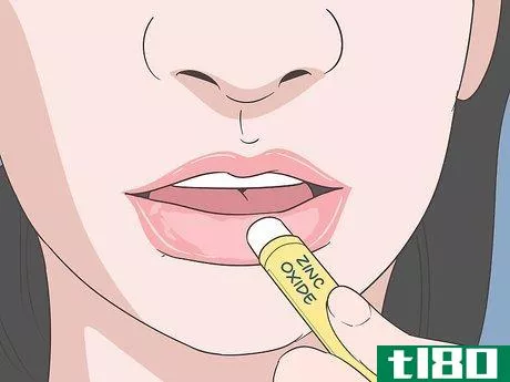 Image titled Get Rid of a Cold Sore with Home Remedies Step 5