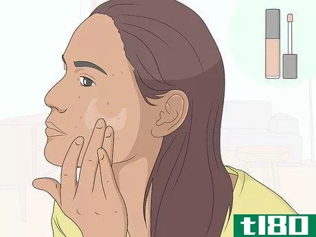 Image titled Get Rid of Acne Scars at Home Without Chemicals Step 8