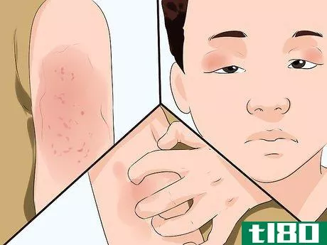 Image titled Identify a Seasonal Allergy Reaction in Young Children Step 3