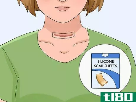 Image titled Hide a Thyroidectomy Scar Step 10