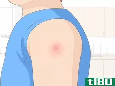 Image titled Get Vaccinated Step 10