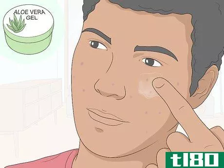 Image titled Get Rid of Acne Scars at Home Without Chemicals Step 2