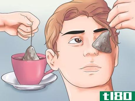 Image titled Get Rid of Bags Under Your Eyes Step 4
