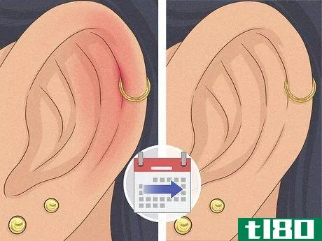 Image titled Is It Safe to Pierce Your Own Cartilage Step 23
