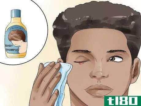 Image titled Get Rid of a Stye Step 8