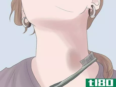 Image titled Get Rid of a Hickey Fast Step 4