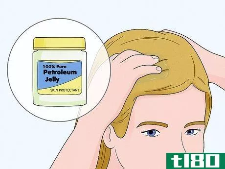 Image titled Get Rid of Head Lice Naturally Step 2