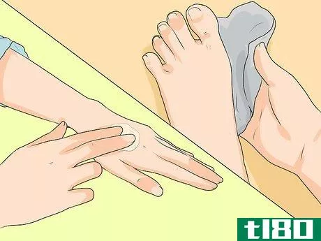 Image titled Get Rid of Calluses Step 4