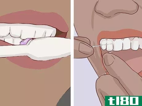 Image titled Know What to Expect when Getting a Tooth Implant Step 18