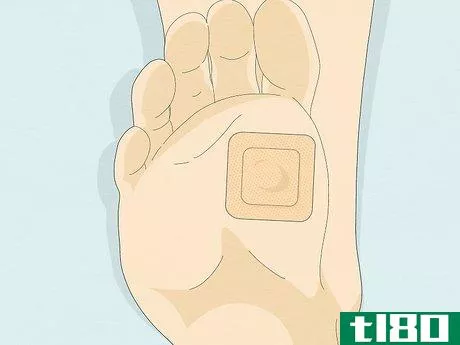 Image titled Get Rid of a Wart at the Bottom of Your Foot Step 4
