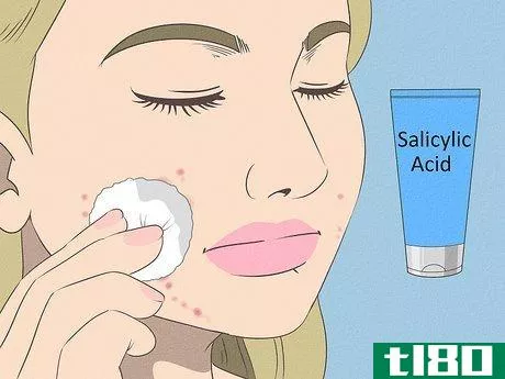 Image titled Get Rid of Acne if You Have Fair Skin Step 4