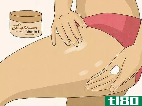 Image titled Get Rid of Stretch Marks Step 6