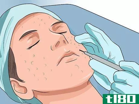 Image titled Get Rid of Large Pores and Blemishes Step 17