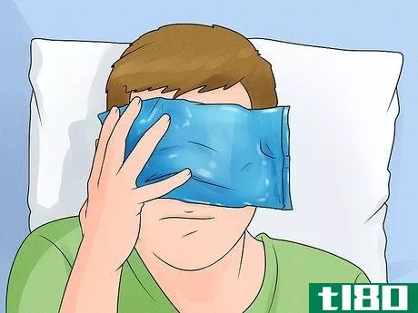 Image titled Get Pepper Spray Out of Eyes Step 9