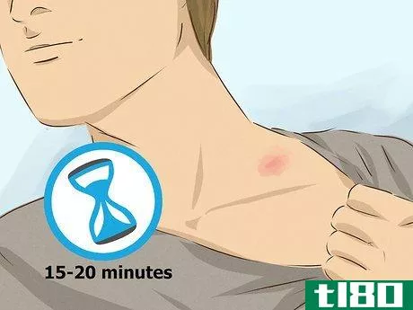 Image titled Hide a Hickey Step 9