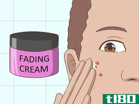 Image titled Get Rid of Acne Cysts Fast Step 19