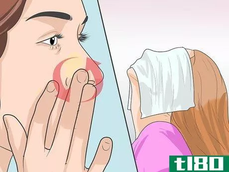 Image titled Get Rid of Acne on Your Nose Step 11