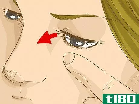 Image titled Get an Eyelash Out of Your Eye Step 5