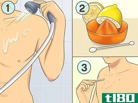 Image titled Get Rid of Acne Scars on Your Chest Step 12